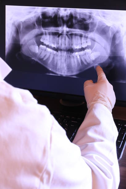 Best Chipped Tooth Repair Near Me  in Lemon Hill, CA