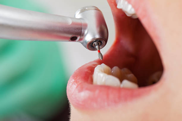 Best Emergency Gum Pain Relief  in Lemon Hill, CA